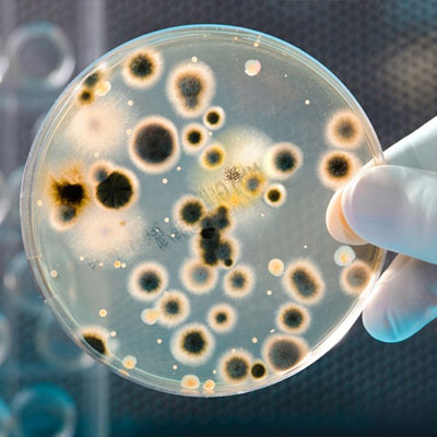 Lab tech holding petri dish with mold growth.